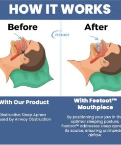 Soothie AirFlow Mouthpiece