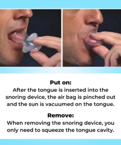 SleepEase Mouthguard