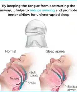 SleepEase Mouthguard