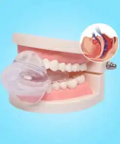 SleepEase Mouthguard