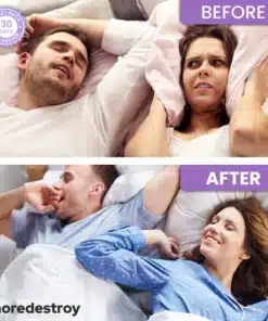 QuietNights Tongue Retainer 2