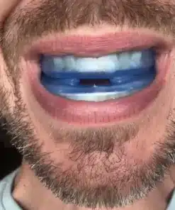 Honex Anti Snoring Mouthpiece 5